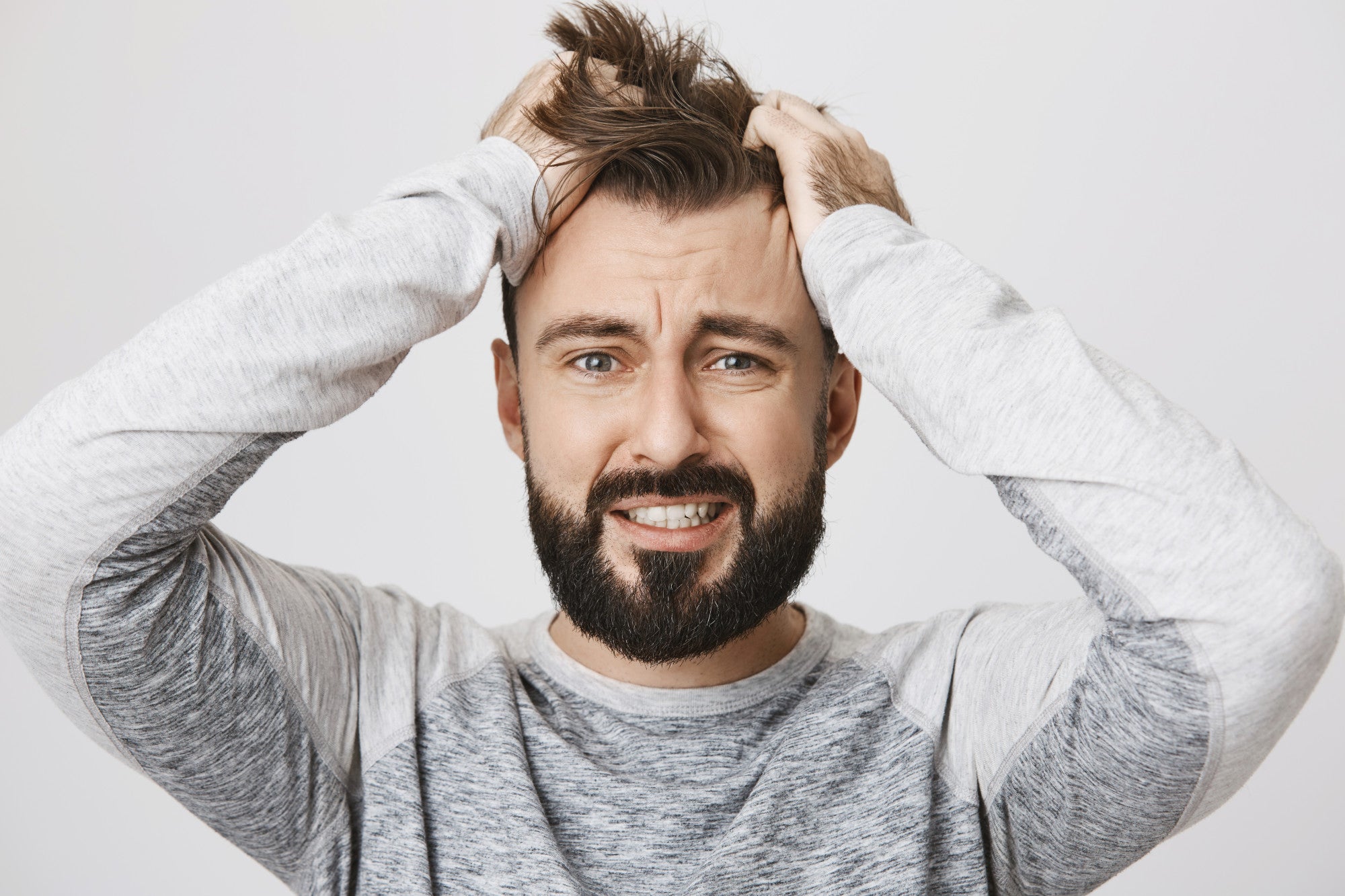 Top Myths about Hair Loss in Men